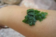 Homemade Remedies for the Relief of Insect Stings and Bites